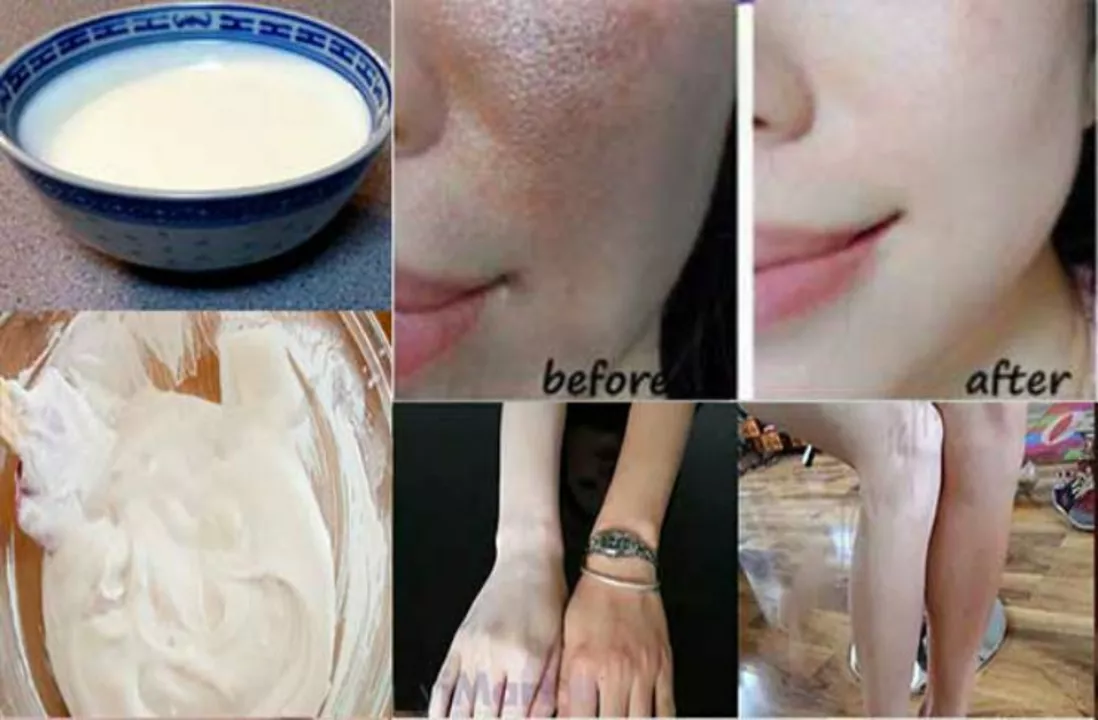DIY skincare recipes featuring allantoin for various skin concerns